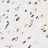 EDF1 Rabbit Polyclonal Antibody