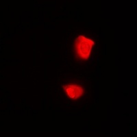 PSMA2 Rabbit Polyclonal Antibody