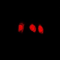 PSMC4 Rabbit Polyclonal Antibody