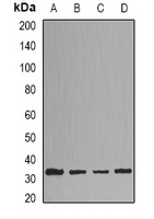 HNMT Rabbit Polyclonal Antibody