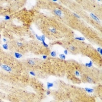 HNMT Rabbit Polyclonal Antibody