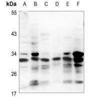 PRG2 Rabbit Polyclonal Antibody