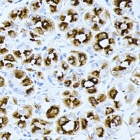 PRG2 Rabbit Polyclonal Antibody