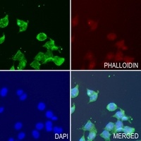 PRG2 Rabbit Polyclonal Antibody