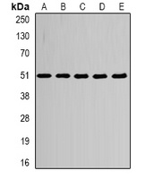 Alpha-tubulin 4a Rabbit Polyclonal Antibody