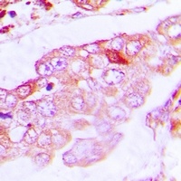 Alpha-tubulin 4a Rabbit Polyclonal Antibody