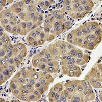UQCRC2 Rabbit Polyclonal Antibody