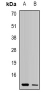 UQCR10 Rabbit Polyclonal Antibody