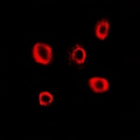 RRM2 Rabbit Polyclonal Antibody