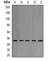 eIF4A1 Rabbit Polyclonal Antibody