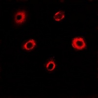 eIF4A1 Rabbit Polyclonal Antibody