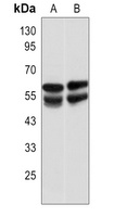 IRSp53 Rabbit Polyclonal Antibody