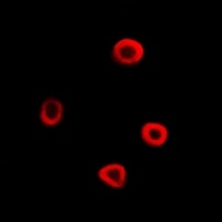IRSp53 Rabbit Polyclonal Antibody