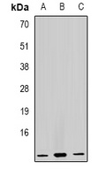 GHRH Rabbit Polyclonal Antibody
