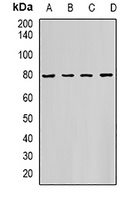 HADHA Rabbit Polyclonal Antibody
