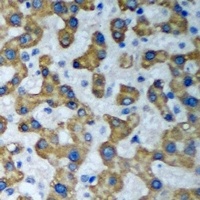 HADHA Rabbit Polyclonal Antibody