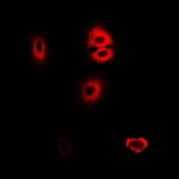 HADHA Rabbit Polyclonal Antibody