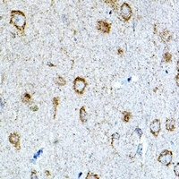IL-1R3 Rabbit Polyclonal Antibody