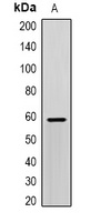 SCP2 Rabbit Polyclonal Antibody