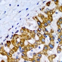 SCP2 Rabbit Polyclonal Antibody