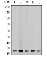 CHMP2B Rabbit Polyclonal Antibody