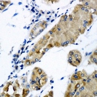 CHMP2B Rabbit Polyclonal Antibody