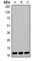 NPC2 Rabbit Polyclonal Antibody