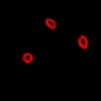 NPC2 Rabbit Polyclonal Antibody