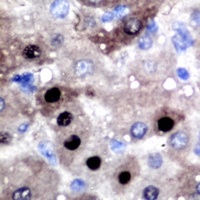 BCL11A Rabbit Polyclonal Antibody