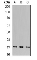 UBE2C Rabbit Polyclonal Antibody