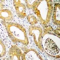 UBE2C Rabbit Polyclonal Antibody