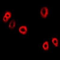 UBE2C Rabbit Polyclonal Antibody