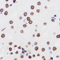 PRDM14 Rabbit Polyclonal Antibody