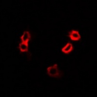 HAX1 Rabbit Polyclonal Antibody