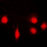 SH2B1 Rabbit Polyclonal Antibody