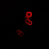 GABARAP Rabbit Polyclonal Antibody