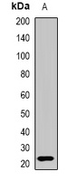 Interferon lambda-3 Rabbit Polyclonal Antibody