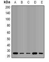 QDPR Rabbit Polyclonal Antibody