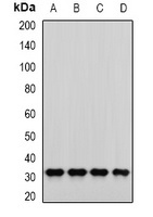PNP Rabbit Polyclonal Antibody
