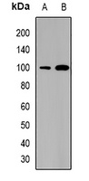 SATB1 Rabbit Polyclonal Antibody