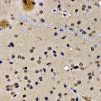 SATB1 Rabbit Polyclonal Antibody