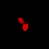 SATB1 Rabbit Polyclonal Antibody