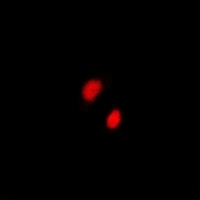 CGBP Rabbit Polyclonal Antibody