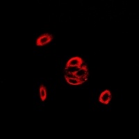 Fis1 Rabbit Polyclonal Antibody