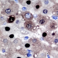 PRMT2 Rabbit Polyclonal Antibody