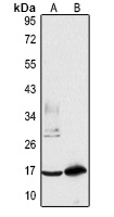 LSm4 Rabbit Polyclonal Antibody
