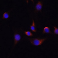 HuC Rabbit Polyclonal Antibody