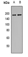 GW182 Rabbit Polyclonal Antibody