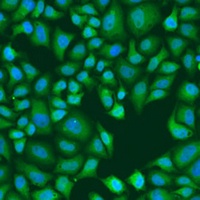 GW182 Rabbit Polyclonal Antibody