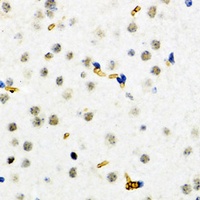 ESET Rabbit Polyclonal Antibody